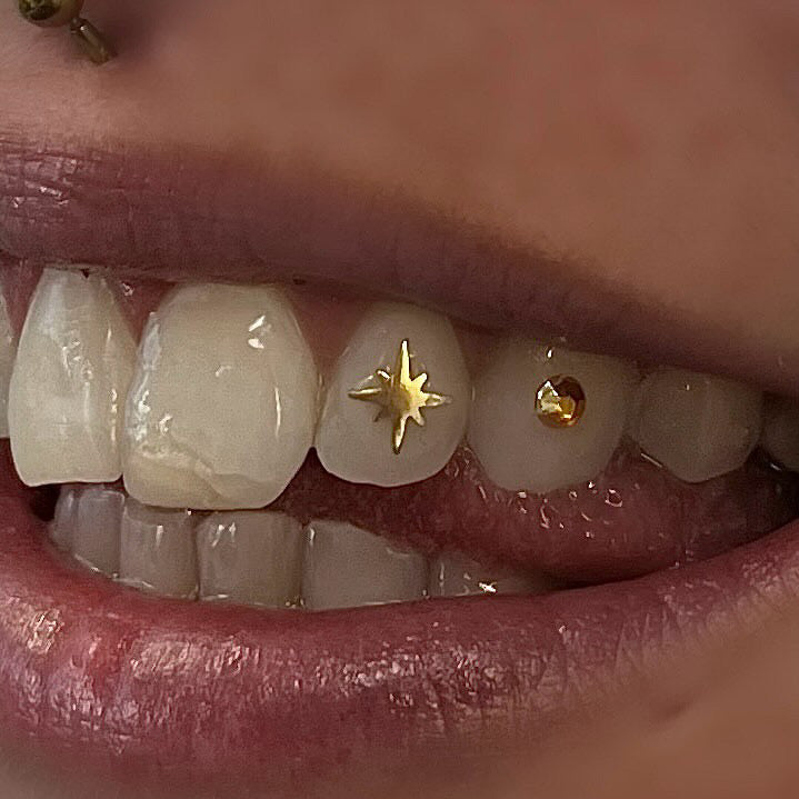 Sparkle Tooth Charm