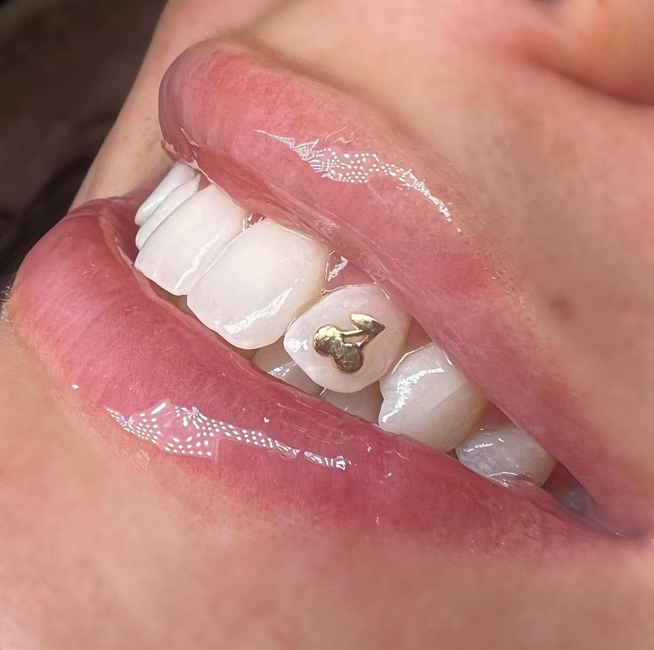 Cherry Tooth Charm