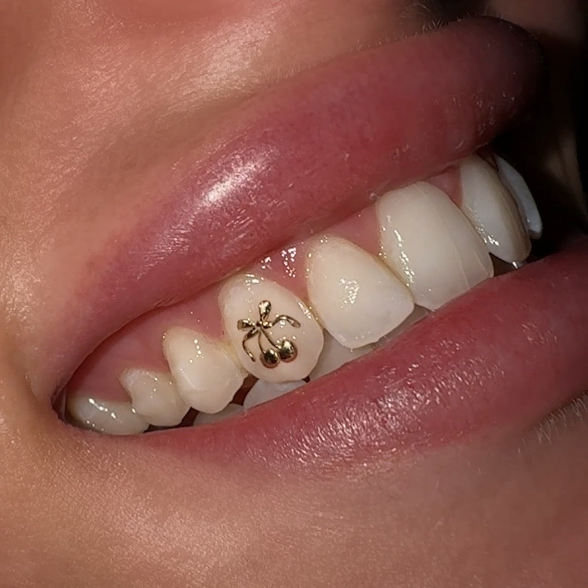 Cherry Bow Tooth Charm