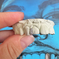 Diamond Gap Filler Grillz - Grillz Australia