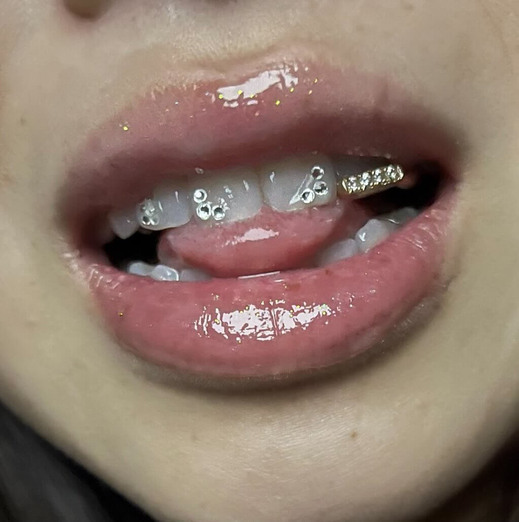 Iced out grillz hot sale in mouth