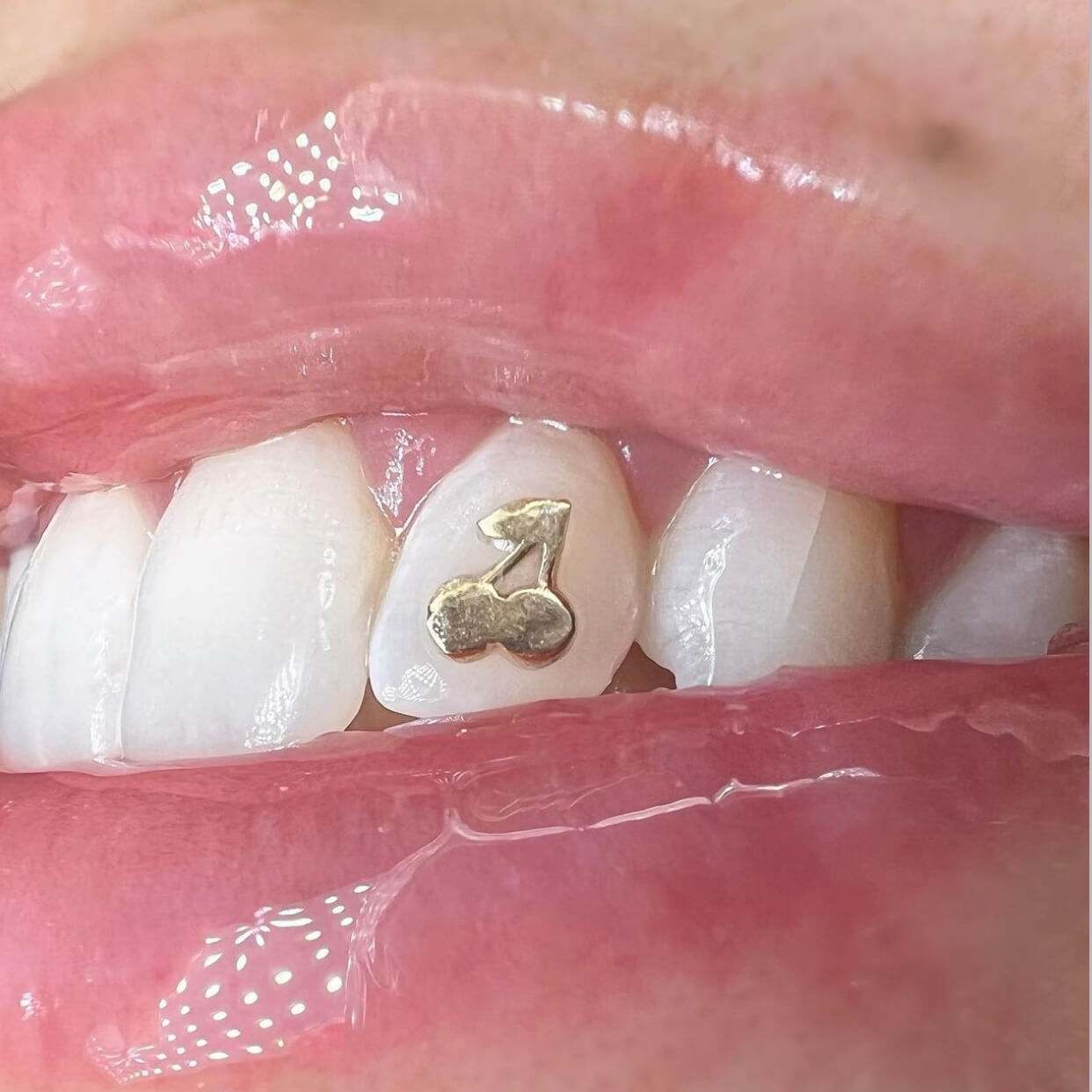 Wholesale Tooth Gems, 18K Gold Web