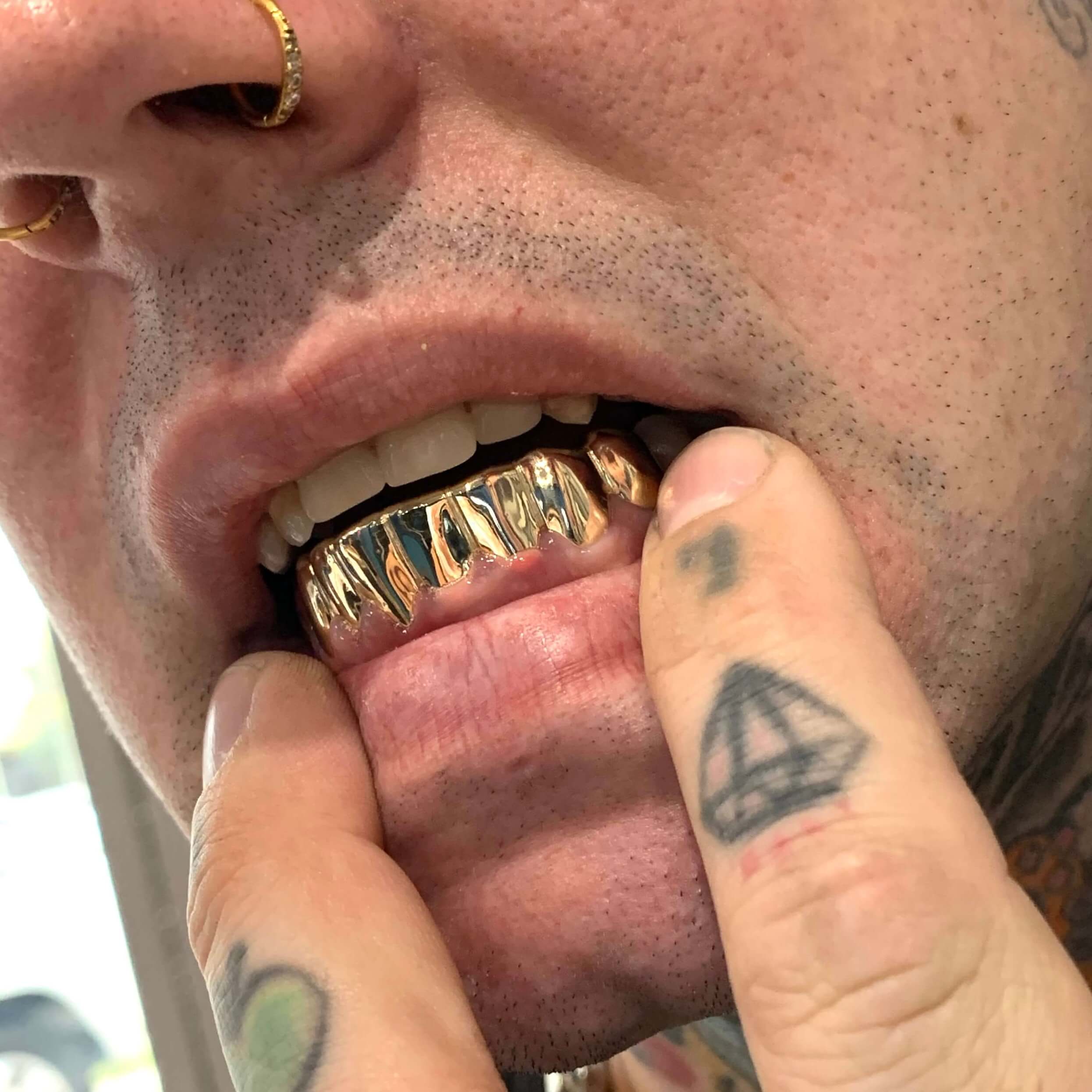 JAG goldtoothcult  Instagram photos and videos